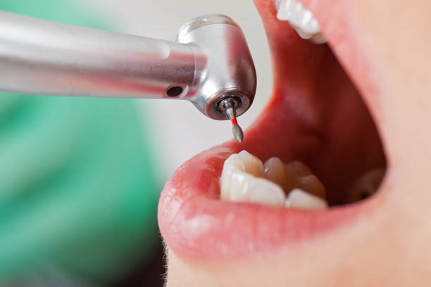 Best Dentist Open Late Near Me  in Bartonsville, MD
